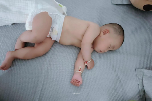 赤峰六个月宝宝眼睛散光